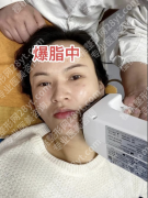 做钻石超塑脸部爆脂多久可以化妆？不同肤质化妆时间及注意事项如下