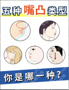 嘴凸怎么办？别慌，3类方案帮你轻松“收”回去