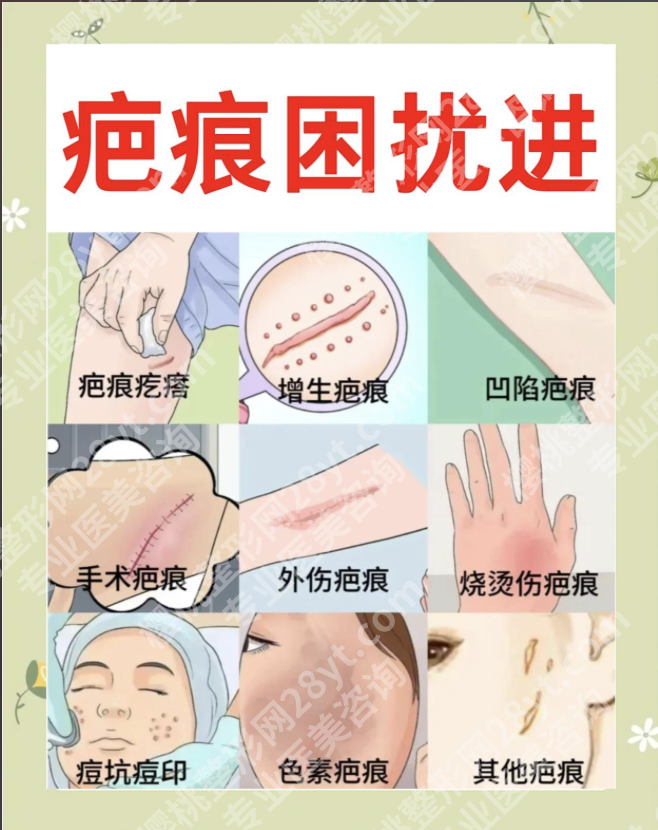 上海华山医院去疤痕怎么样？3个核心优势，别家比不了