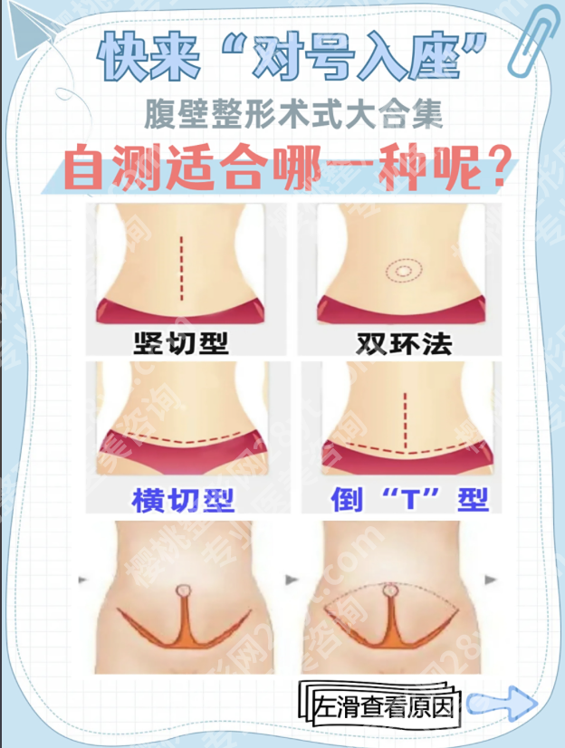 苏州腹壁整形术好的医院：选对以下几家，腹壁整形才是“逆袭神器”