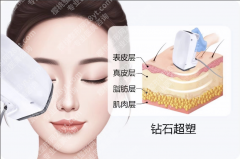 钻石超塑和打瘦脸能一起做吗？3种搭配方案，不同需求选不同