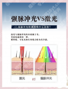 点阵激光和脉冲激光有什么区别？一篇看懂如何选对激光美容项目