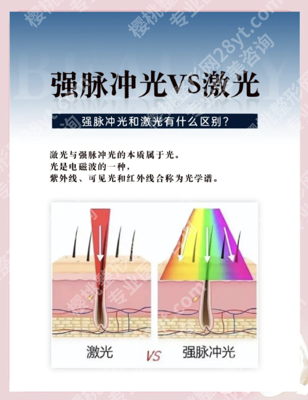 点阵激光和脉冲激光有什么区别？一篇看懂如何选对激光美容项目