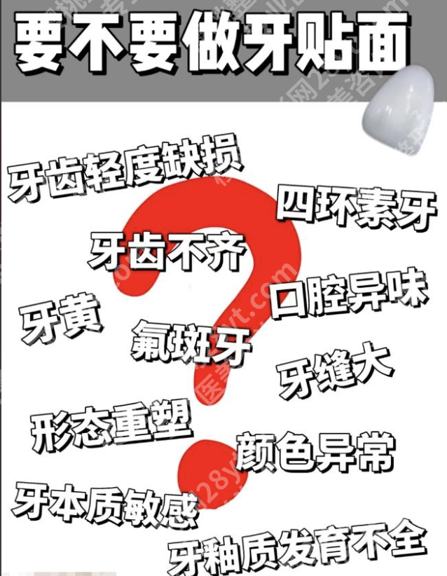 做牙贴面的好处和坏处都给你讲透，看完这篇再决定