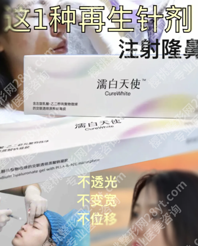 濡白天使隆鼻维持多久？12个月还是24个月，附延长技巧