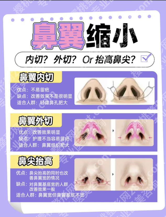 切开鼻孔缩鼻翼要多久？从手术到自然全流程，求美者必看