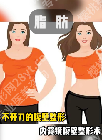 福州腹壁整形医院排名：量身定制一份专业医院选择指南