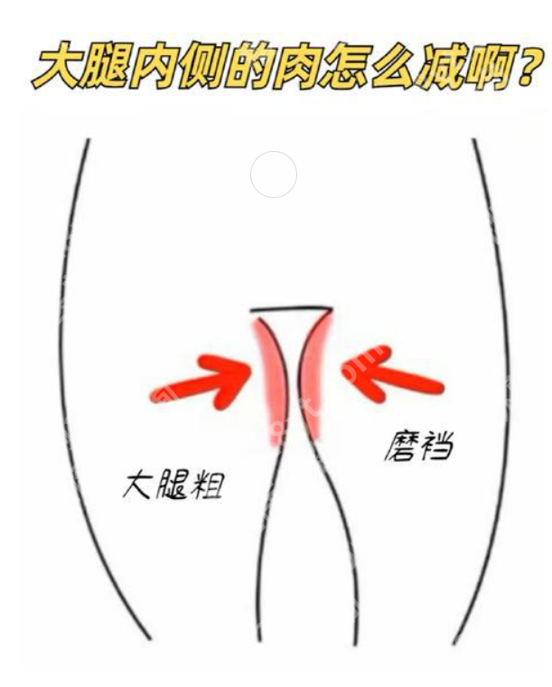 合肥大腿吸脂多少钱？哪家好？这些经过相关部门审批合格，可以放心选择