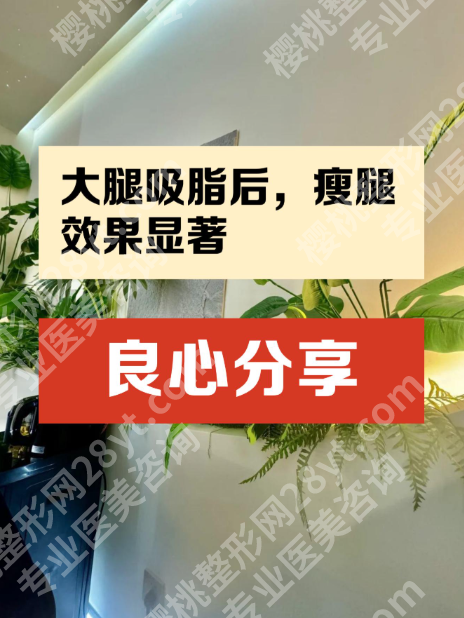 深圳大腿吸脂的价钱多少？哪家好？3种选择3 种结果，价格和效果成正比