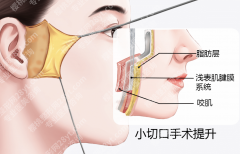 南京医院可以做小拉皮手术吗？3家靠谱机构+2张表，下颌线/法令纹修复全实测