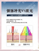 脉冲激光和点阵激光的区别：来看对应方案+费用表（附学术依据）