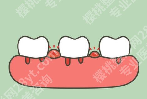 二十多岁整牙来得及吗？矫正费用更新吗，项目咨询盘点