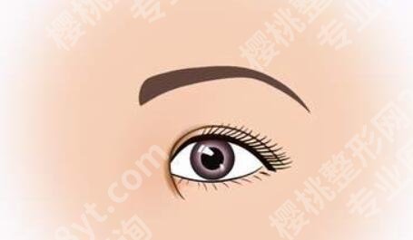 做切眉手术多长时间能恢复？过来人实测：7天拆线、1个月见效果，这些坑别踩