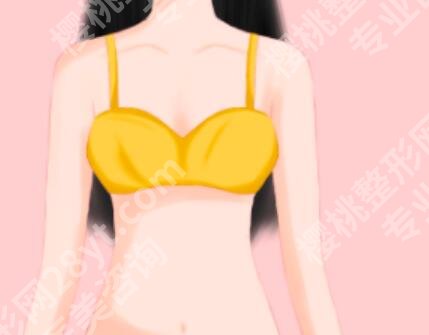 超声波抽脂对身体的危害有哪些？这些身体“小麻烦”得提前知道