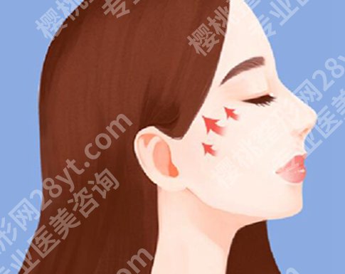 脂肪填充修复方式是怎么样的？哪些情况需要做脂肪修复？一起整理看看