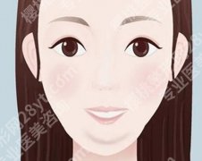 嘴角整形恢复期要注意什么？项目咨询查看，不要错过哦