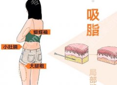 环吸和体雕哪个效果好？内行人扒清差异，选对不花冤枉钱