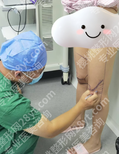 广州大腿吸脂有名医生：5位顶流医生拆解，从技术到案例全透明，附价格表
