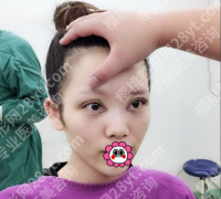 哈尔滨瑞丽哪个大夫割双眼皮好？3个硬标准比“名气”靠谱10倍