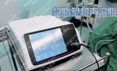 超声溶脂对身体有害吗？2025实测+风险拆解，安全变美不踩雷