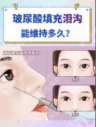 玻尿酸填充泪沟能管多久？3组真人案例+2份数据，揭秘维持时长真相