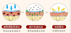 济南妊娠纹修复哪家医院好？3个真实案例+硬核数据帮你选对