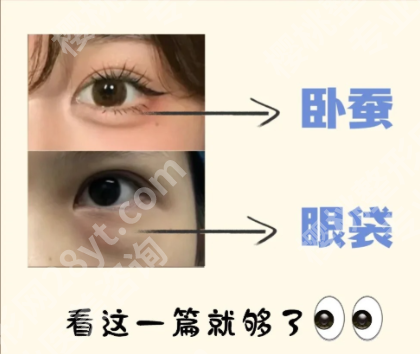 填卧蚕会流到眼袋位置吗？3个关键因素+避坑指南，爱美党必藏