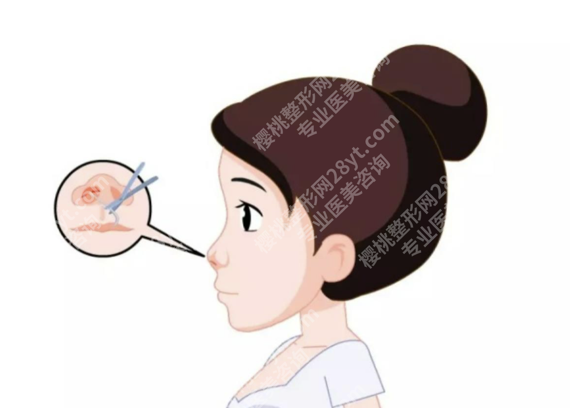 北大医院做鼻子手术谁做得好？一篇读懂选医攻略+优质医生推荐