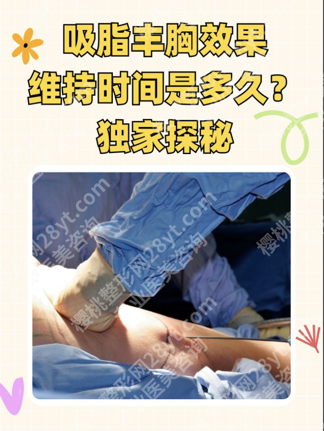 做脂肪丰胸能保持多久？不是永久也能美到十年+