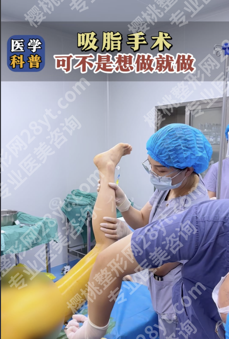 深圳北大医院吸脂全攻略！本地人私藏干货，价格、医生、避坑全给你扒明白