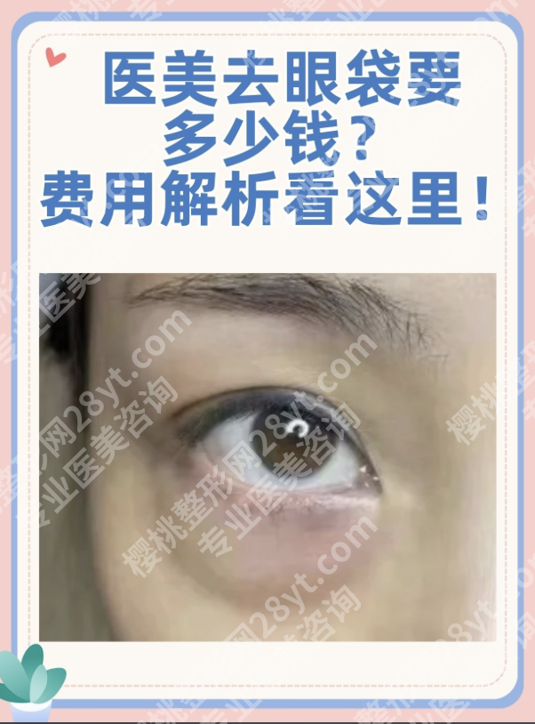 去眼袋手术需要多少钱？影响价格的6个关键维度+真实案例全拆解