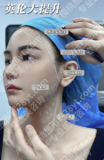 英伦大提升有后遗症吗？别被焦虑带偏！真相在这里
