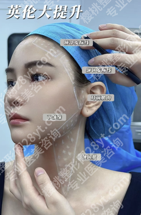 英伦大提升有后遗症吗？别被焦虑带偏！真相在这里