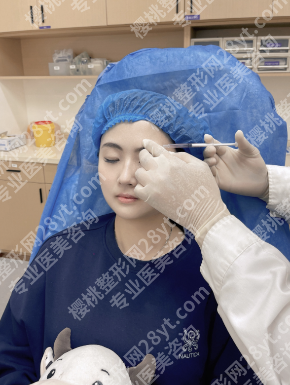 眉弓填充能维持多久？内行人实话实说，附3种材料真实维持数据