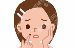 去太田痣激光疼吗？麻醉方式、恢复期反应、结痂护理与反黑应对详解