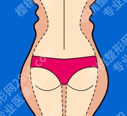 腰腹环吸的脂肪可以填屁股吗？过来人实测般的干货科普