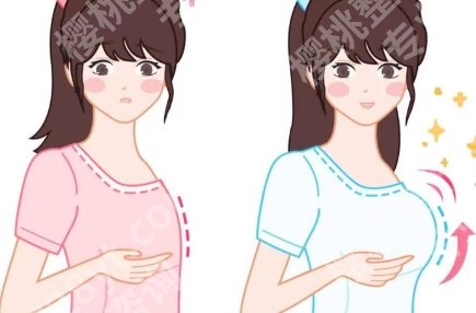 脂肪丰胸和假体丰胸哪个更安全？隆胸方式优缺点、风险与适合人群对比