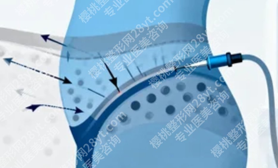 南京吸脂专家排名，前五名实力测评，谁能让你躺着瘦且不反弹？
