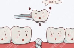 上海中山医院种牙多少钱？材料选择、收费区间、就诊流程一篇讲明白