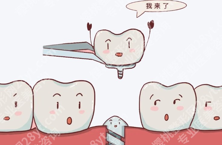 上海中山医院种牙多少钱？材料选择、收费区间、就诊流程一篇讲明白
