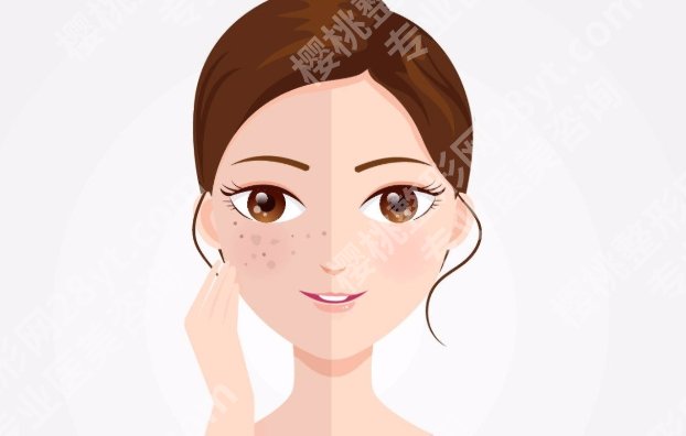 广东省皮肤病医院激光整形美肤中心，祛斑祛痘项目合集、价格区间揭秘