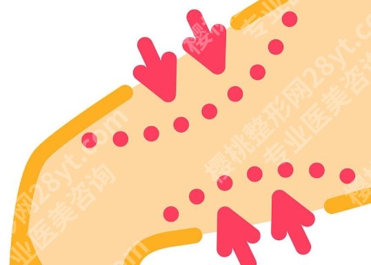 广州大腿吸脂手术价格，医院档次、抽脂量多少怎么影响费用？