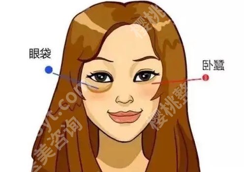西安西京医院去眼袋多少钱？6k起！项目优势+常见问题解答！