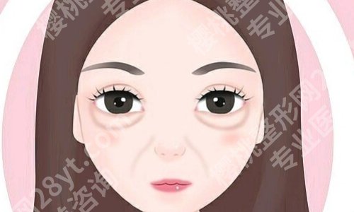 八大处去眼袋挂哪个科？技术实力雄厚、医师团队强大