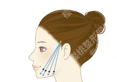 北京八大处拉皮手术好的医生有那些？赵延勇、杨明勇、侯典举技术靠谱