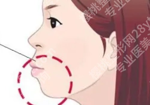 西京医院颌面外科专家有哪位？刘恒鑫、张曦等等实力上榜