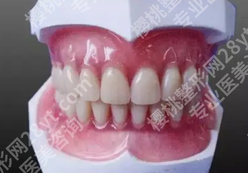 北京协和种牙多少钱？低至6800元起/颗！口腔科优势解析
