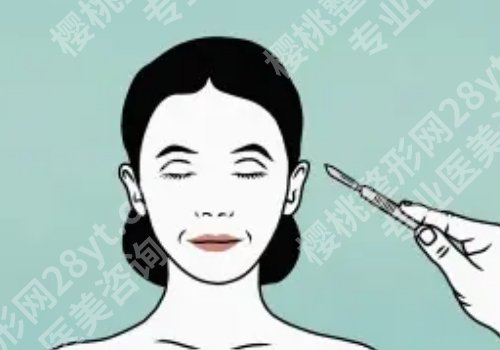 西京医院做拉皮多少钱？3w起！性价比高、案例多