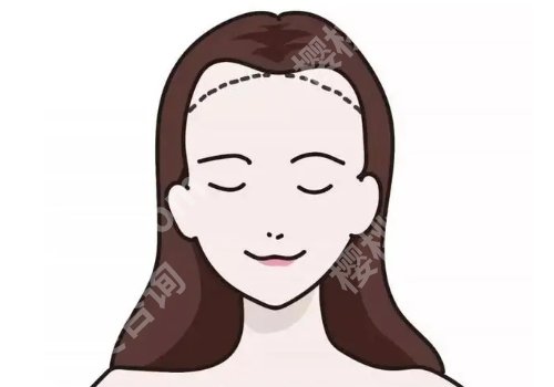 八大处植发费用多少？8000元起，价格明细|人气医生|网友点评