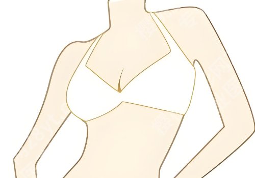 上海九院抽脂隆胸多少钱？2.5w起！轻松获得美胸